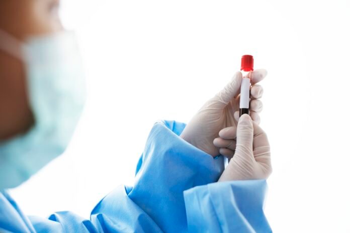 Médico contesta incidência de neoplasia pelo Car-T Cell
